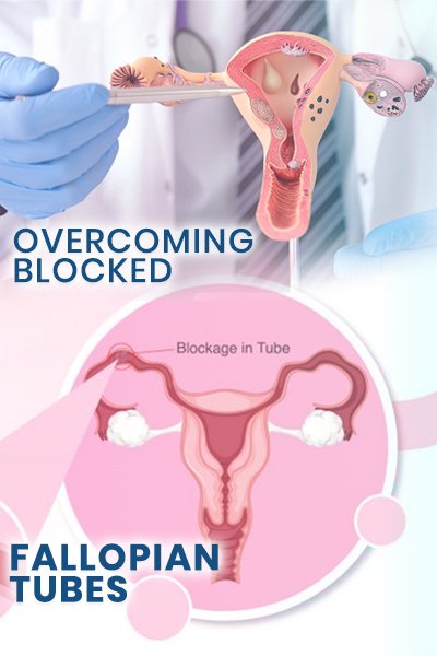 Blocked Tubes